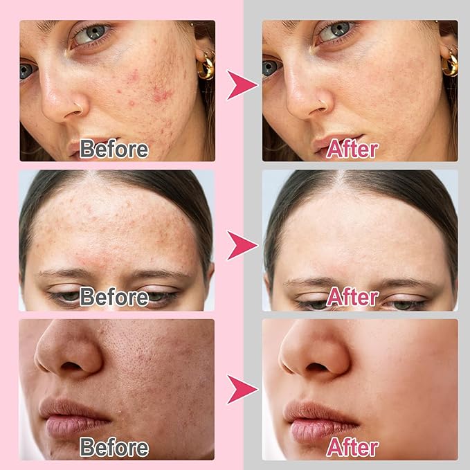 Turmeric face scrub pads, 120pcs