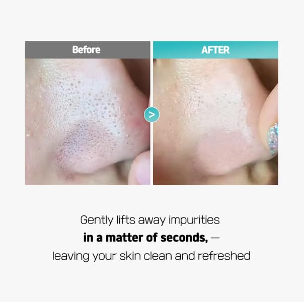 Centella Poreless Deep Cleansing Oil (150ml, 5.07 fl oz) | Lightweight Cleanser for Makeup & Blackhead Removeral | Pore Care with14 Plant-Based Oil | Korean Skincare