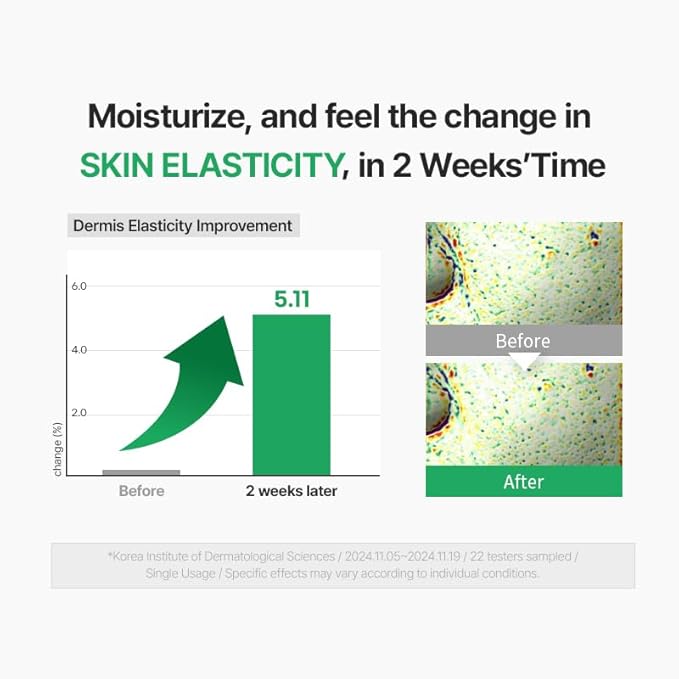 Zipiderm EGF Skin Barrier Intensive Cream, Barrier Repair Cream, Korean Hydrating Moisturizer for Sensitive, Damaged Skin, Redness & Dryness, Non-comedogenic tested, 2.70 fl oz