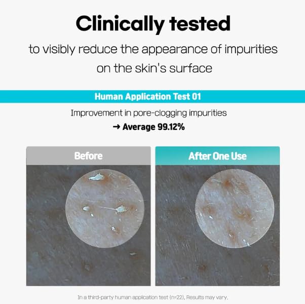 Centella Poreless Deep Cleansing Oil (150ml, 5.07 fl oz) | Lightweight Cleanser for Makeup & Blackhead Removeral | Pore Care with14 Plant-Based Oil | Korean Skincare