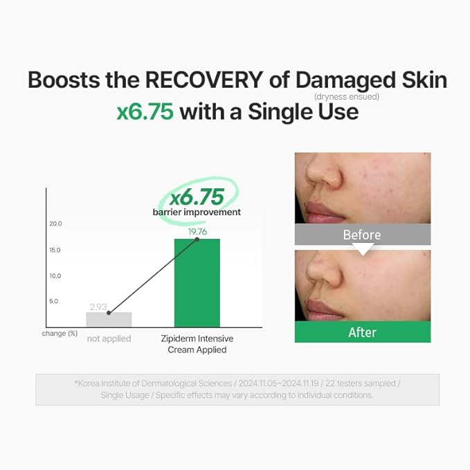 Zipiderm EGF Skin Barrier Intensive Cream, Barrier Repair Cream, Korean Hydrating Moisturizer for Sensitive, Damaged Skin, Redness & Dryness, Non-comedogenic tested, 2.70 fl oz