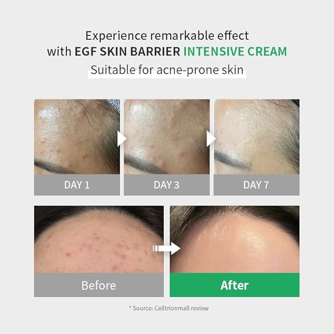 Zipiderm EGF Skin Barrier Intensive Cream, Barrier Repair Cream, Korean Hydrating Moisturizer for Sensitive, Damaged Skin, Redness & Dryness, Non-comedogenic tested, 2.70 fl oz