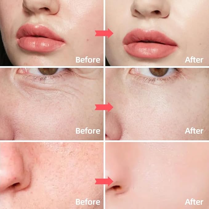 Retinol & Collagen Face Cream – Anti-Aging Moisturizer for Wrinkles & Fine Lines | Hyaluronic Acid & Peptides | Hydrates & Restores Skin Elasticity