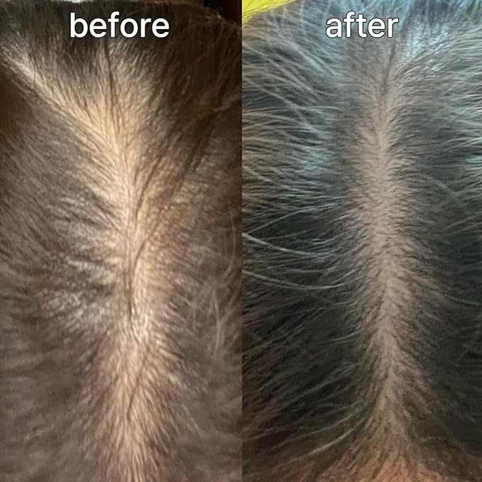 Scalp&Hair Serum for Thinning Hair by Vivelab,15ml–Clinically Tested,Nourishing Formula with Biotin,peptide. Promotes Healthy Scalp&Fuller-Looking Hair