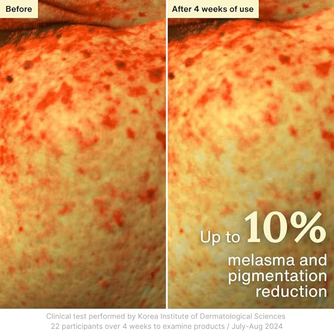 Rothea Resilience Cream, Anti-Aging with Bakuchiol 10,000ppm (Natural Retinol Alternative), Face Moisturizer, Neck Cream with Collagen, Ceramides, Peptides, Niacinamide, Korean Skin Care, 1.7 oz