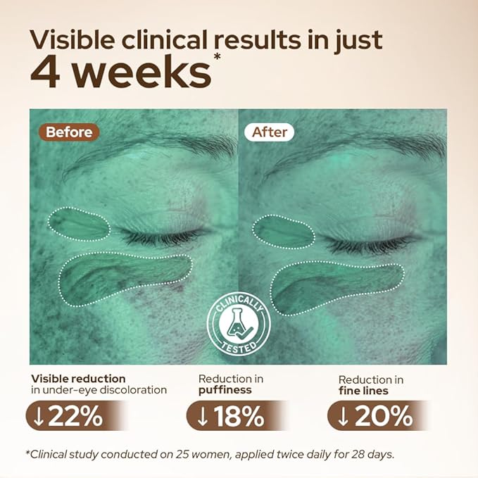 Youth 1700 Caffeine Eye Cream, Under Eye Brightener & Anti-Aging with Peptides, Hyaluronic Acid, Niacinamide, Bakuchiol, Vietnamese Ginseng for Dark Circles, Puffiness, Wrinkles and Hydrating Skin