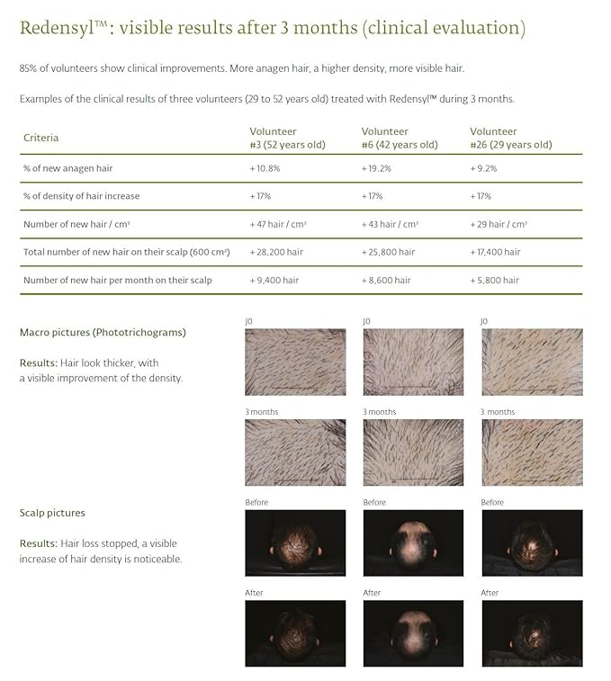 LUXXUL Hair Growth Support Serum, 50ML - Natural Actives Redensyl Hair Serum for Healthier, Thicker and Fuller Looking Hair - Made in USA