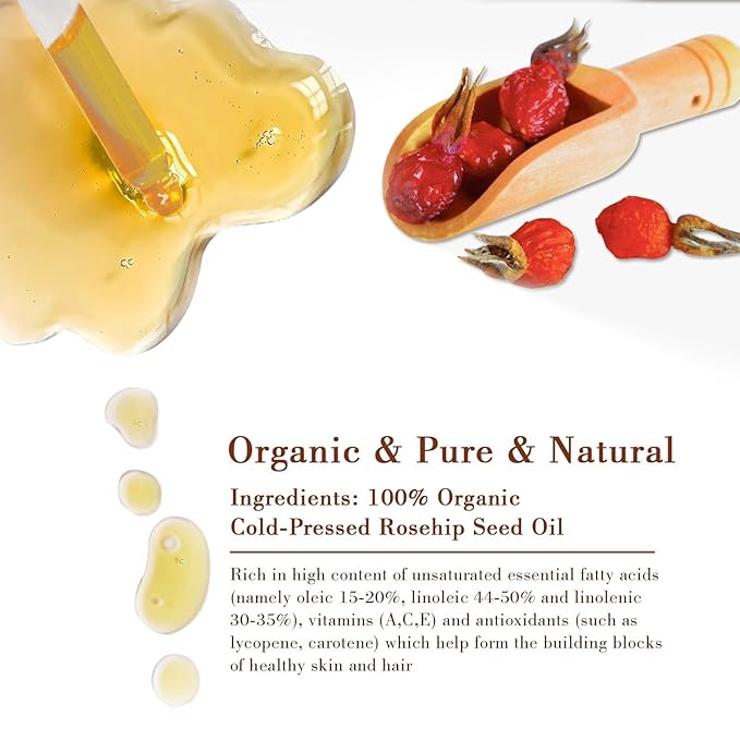 100% Pure Natural Rosehip Oil for Face, USDA Certified Organic, Cold Pressed, Extra Virgin, Hexane Free Rosehip Seed Oil for Anti-Aging, Acne Scar Treatment, Skin & Hair Care (4.22 oz/125 ml)