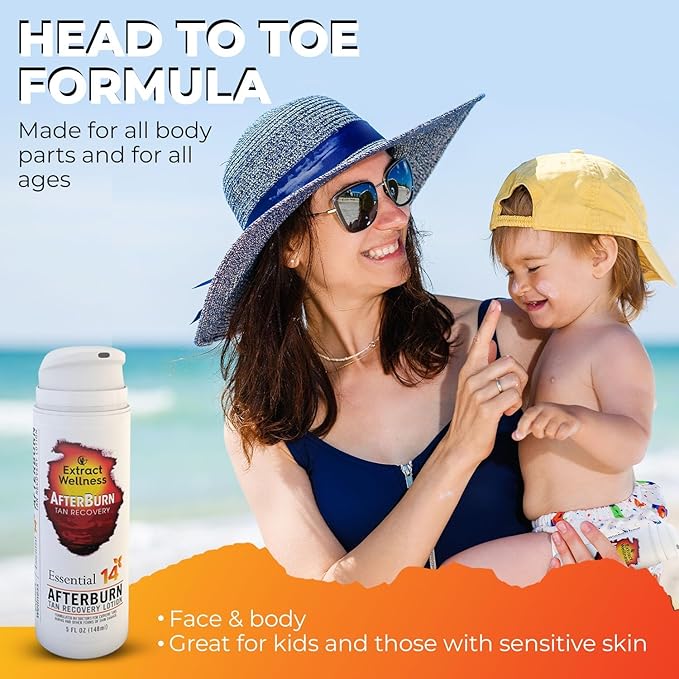 All-in-One AfterBurn Tan Recovery Lotion – Doctor-Formulated Aftersun Lotion w/Natural Ingredients & 14 Essential Oils for All Ages – After Sun Care for Deep Hydration & Peeling Minimization