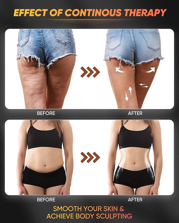 ONUEMP 3-in-1 Stainless Steel Therapy Massage Tool, Gua Sha Paddle & Swedish Cup & Mushroom Massager, Maderoterapia Kit Colombiana for Lymphatic Drainage, Cellulite Remover, Body Sculpting