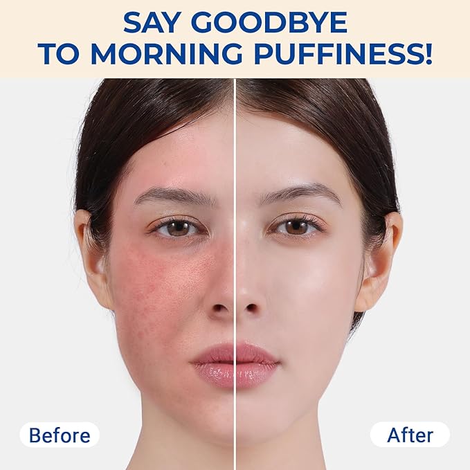 MORGLES Ice Roller for Face and Eyes, Ice Face Roller for Women Skin Care, Cold Facial Roller for Puffiness, Migraine Relief and Lymphatic Drainage