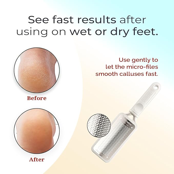 Microplane Colossal Foot File Scraper - The Original Stainless Steel Foot Rasp, Dead Skin/Callus Remover for Feet, Gentle Foot Scrubber, Pedicure Tools for Salon-Quality Foot Care, White
