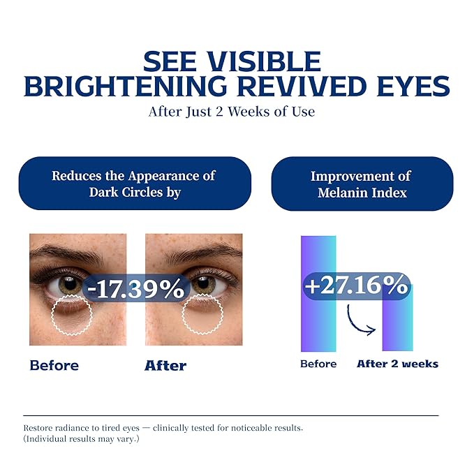 Re.SPN Peptide Firming Roller Eye Serum – For Puffy Eyes, Wrinkles & Dark Circles with Gua Sha Applicator, Vegan, Eye Peptide, Niacinamide, K-Beauty (0.67 fl oz)