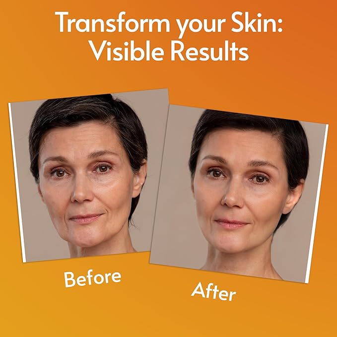 Vitamin C Serum For Face - Anti Aging Formula with Hyaluronic Acid & Vitamin E – Brightening Serum – Treatment for Dark Spots, Tone, Fine Lines & Wrinkles - Microneedling - Korean Skincare - 2 fl oz