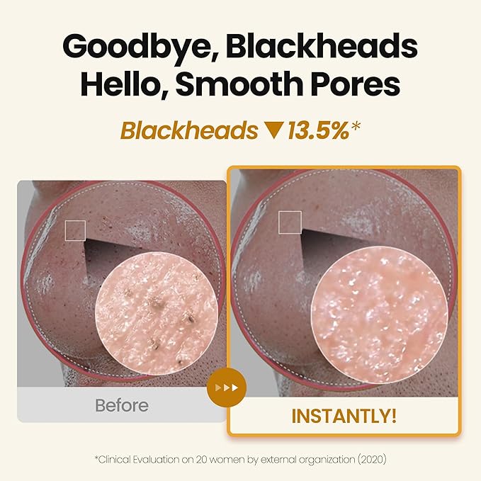 [K-Beauty] Gold Caviar Oil to Foam - All-in-One Korean Face Wash OilBased Foaming Facial Cleanser - Age-Defying, Moisturizing & Skin Firming Makeup Deep Cleansing Oil for Sagging Skin (3.88 fl oz)