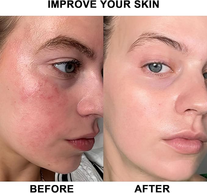 Red Light Devices for Face Full Body Red Light Lamp High Power Infrared Light Panel for Skin Health 660nm