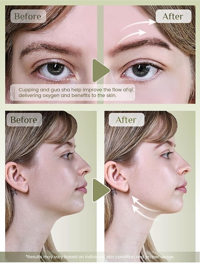 Rena Chris Facial Cupping Set & Gua Sha Facial Tool - Silicone Cupping Set & Jade Gua Sha Stone - Face Cupping Therapy Set for Natural Skin Care, Puffiness, Lip Plumping(Green)