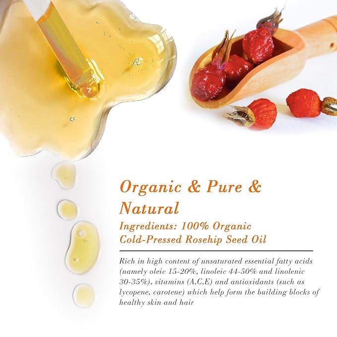 Rosehip Seed Oil for Face (2 oz/60 ml) USDA Certified Organic 100% Pure Natural Cold Pressed Unrefined Rosehip Oil for Skin Anti-Aging, Scar, Hair Moisturizer, Gua Sha Massage, Nails