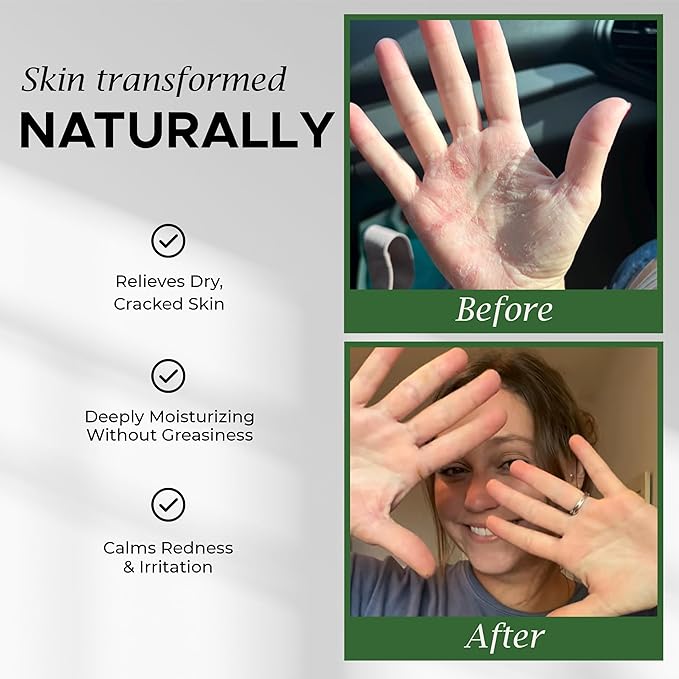 Organic Beef Tallow for Skin – Whipped Tallow Balm for Skin Face and Body with Jojoba Oil and Cocoa Butter – Unscented and Herb-Infused – Large Size 2.5fl Oz Net Wt