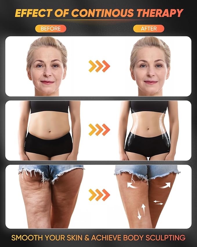 ONUEMP 4-in-1 Stainless Steel Massage Therapy Tools for Ice Body Sculpting, Maderoterapia Kit Colombiana, Gua Sha Scraping Body & Facial Massager for Lymphatic Drainage, Anti Cellulite