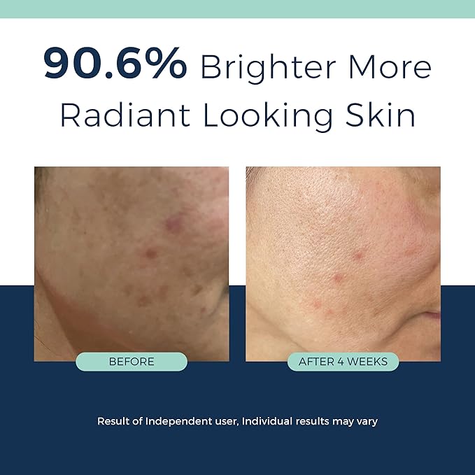 Anti-Aging Retinol Serum for Face- 1% Encapsulated Retinol, Niacinamide & Hyaluronic Acid Improves Wrinkles, Hydration, Skin Texture & Tone. Gentle for Sensitive Skin-Fragrance Free-1 FL OZ