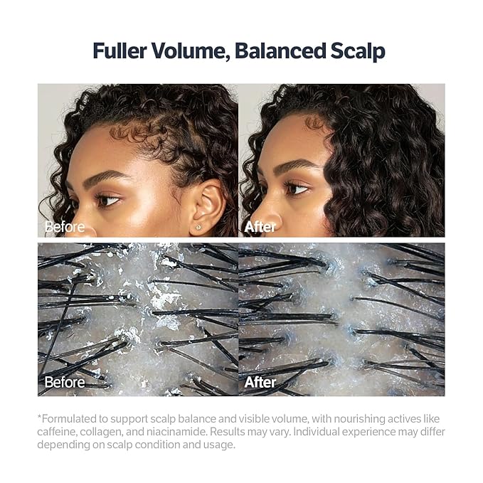 SUNGBOON EDITOR Deep Collagen Retinol Power Boosting Scalp Serum | Roll On Hair Growth, Hair Thickening Serum, Itchy & Dry Scalp Treatment, Caffeine, Biotin, Rosemary – Korean Hair Care, 0.5 fl oz