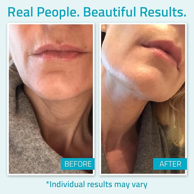 YEOUTH Day Night Face Moisturizer with Hyaluronic Acid, Snail Mucin Cream and Copper Tripeptide, Hydrating Fragrance Free Moisturizer, Face Cream for Women and Men 4oz