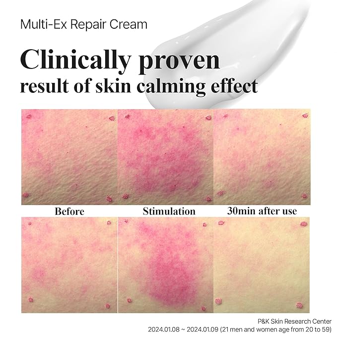 Multi-Ex Repair Cream 100ml – Korean Face Moisturizer with Niacinamide & EGF | Skin Repair Cream for Sensitive Skin | Soothing Facial Moisturizer for Women | Hydrating Moisture