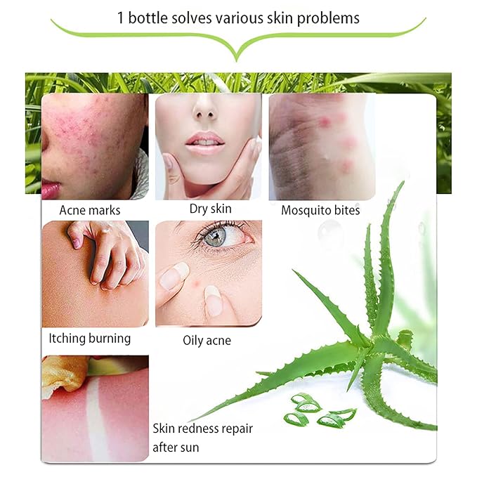 300 ML Natural Aloe Vera Gel -Organic Moisturizing Cream, Soothing and Hydrating, Sunburn and Scar Repair, Care for Face Body Hair