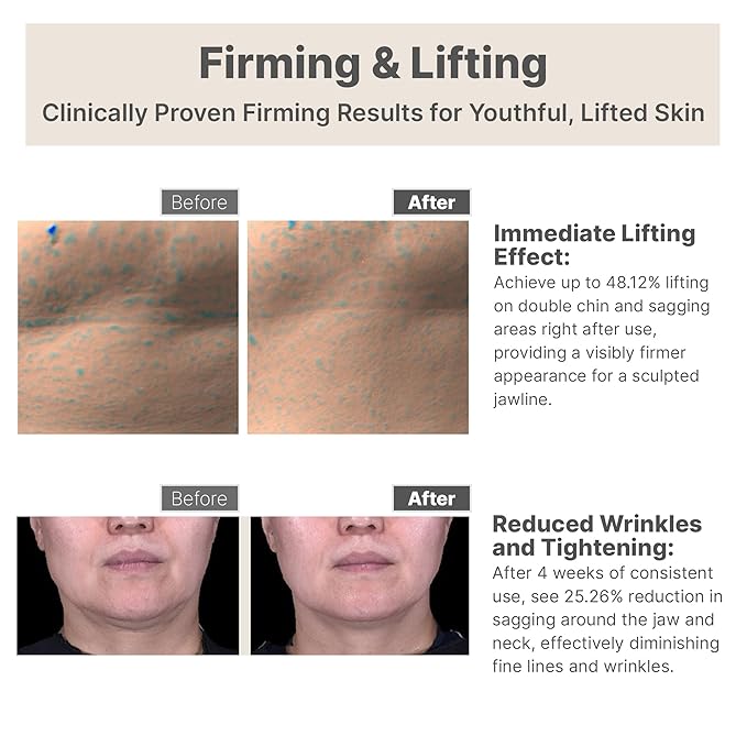 Birch V-Shape Face Cream, Anti-Aging Moisturizer for Firming & Lifting - Korean Skincare Gua Sha Cream- Eye & Neck Tightening for Wrinkles, Puffiness & Dark Circles-Vegan K-Beauty (4.05 Fl Oz)