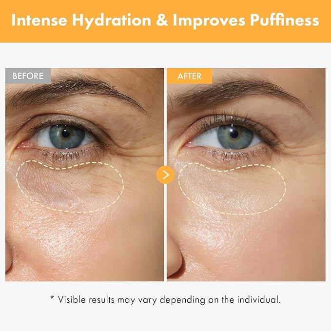 VITA Clinic Vitamin Eye Cream, Korean Skincare with 5% Arbutin, 2% Niacinamide, Hyaluronic Acid, Glutathione, Seabuckthorn Eye Serum for Fine Lines & Wrinkles, Puffiness, 15ml / 0.5 fl. oz.