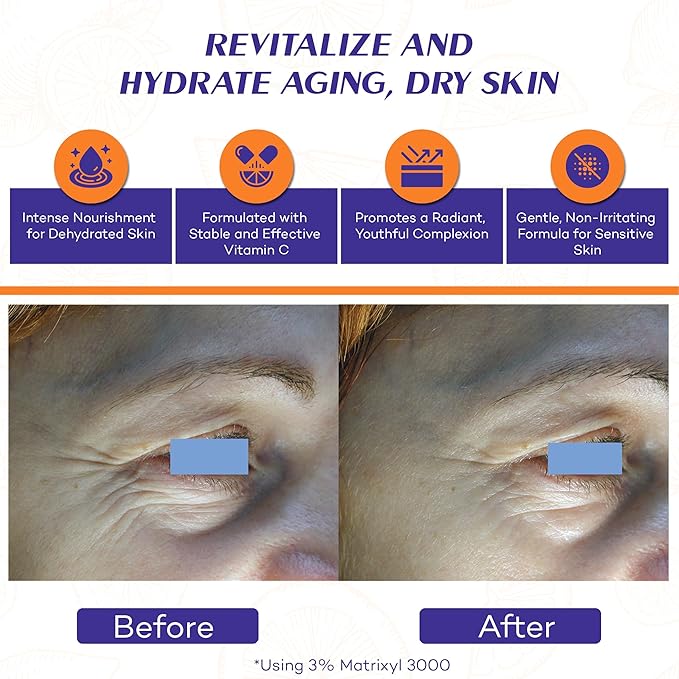 Vitamin C Face Oil Serum – 5% Oil-Soluble Vitamin C (THD Ascorbate) & Peptide Complex (Matrixyl 3000) – Hydrating with Squalane, Rosehip & Pomegranate – For Dry or Mature Skin– 1 fl oz