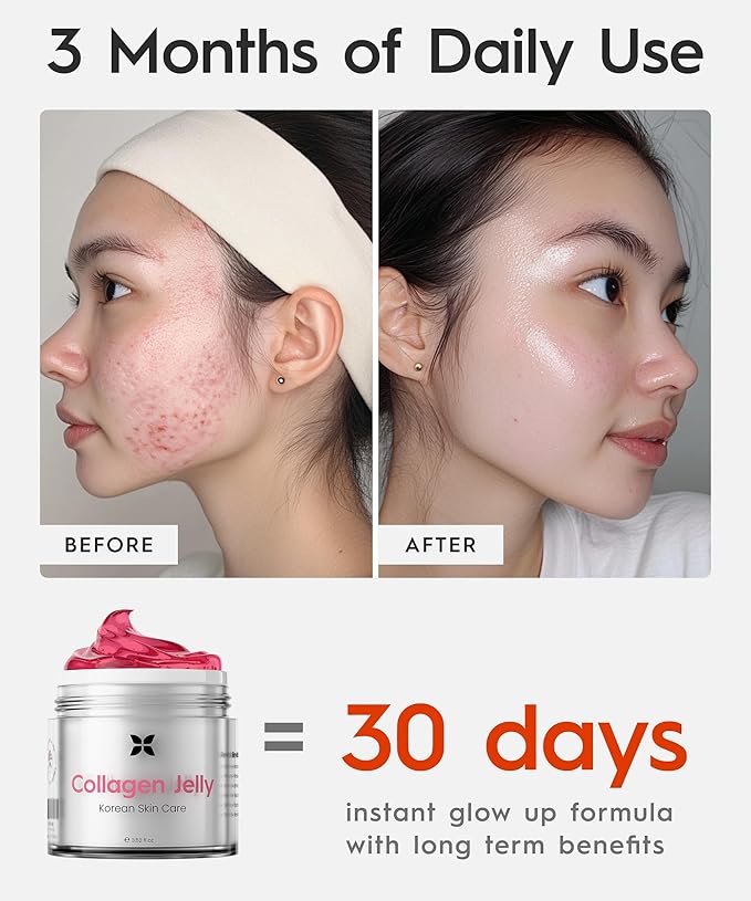 REVO Collagen Jelly – Korean Anti-Aging Plumping Formula with Hydrolyzed Collagen, Niacinamide, Hyaluronic Acid & Vitamin C – Skincare for Glass Glow Skin, Wrinkle Repair & Even Tone