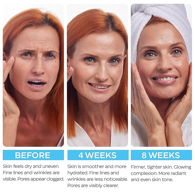 Retinol Cream for Face with Hyaluronic Acid, Day-Night Anti-Aging Moisturizer for Women, Men, Collagen Cream for Face Reduces Wrinkles, Dryness, 1.85 Oz