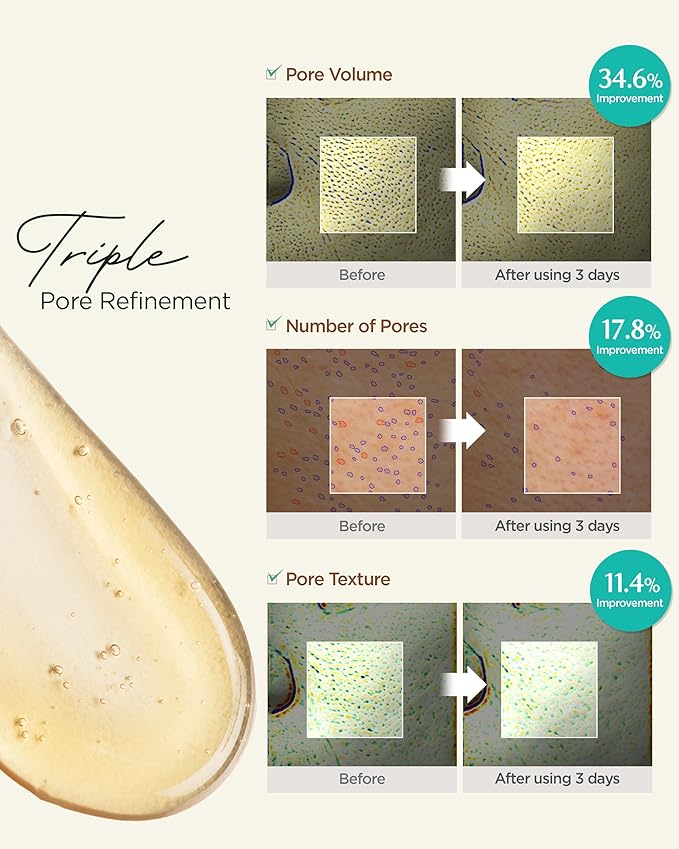 ACWELL Licorice pH Balancing Pore Cleansing Gel Foam - Gentle, Hypoallergenic Facial Cleanser for Clear, Smooth Skin, Deep Pore Cleaning with Licorice Extract, LHA, for All Skin Types, 5.4 fl.oz.