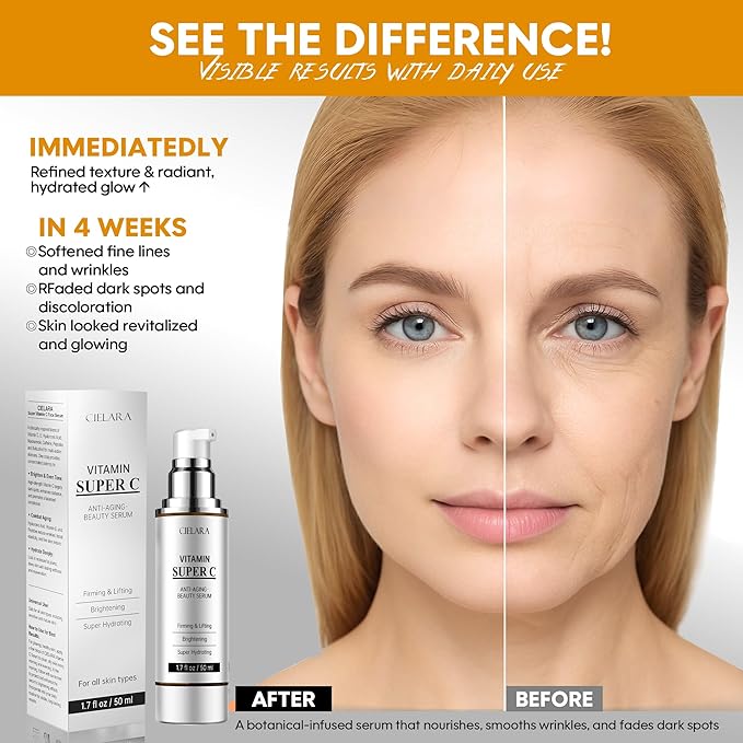 Vitamin C Serum for Face, Anti Aging 20% Super C Serum With Vit C Hyaluronic Acid, Vitamin E, Peptides, Collagen for Dark Spot Remover for Face, tighten, firming, lift, Brightening-1.7 Fl Oz
