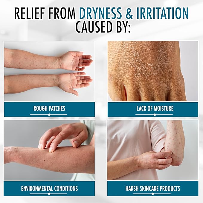 GLY MIRACLE Moisturizing Body Cream Lotion, 12 ounce - Non-Greasy Skin Humectant for Extremely Dry Skin, Hands, Body, and Feet, Light Fresh Scent with Pure Glycerin for Nourishing Hydration.